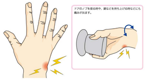 Tfcc 三角線維軟骨複合体 損傷 尺骨突き上げ症候群 聖マリアンナ医科大学 横浜市西部病院