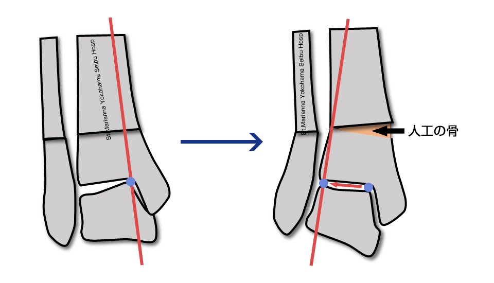 リスクと合併症
